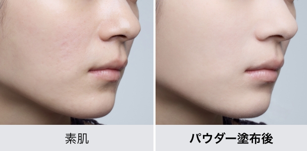 使用前・使用後比較